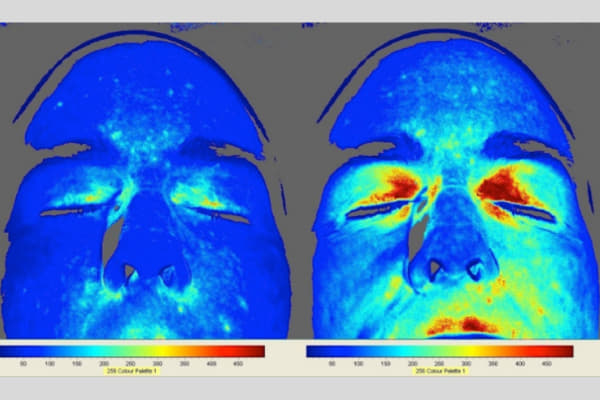 An Earthing Facelift